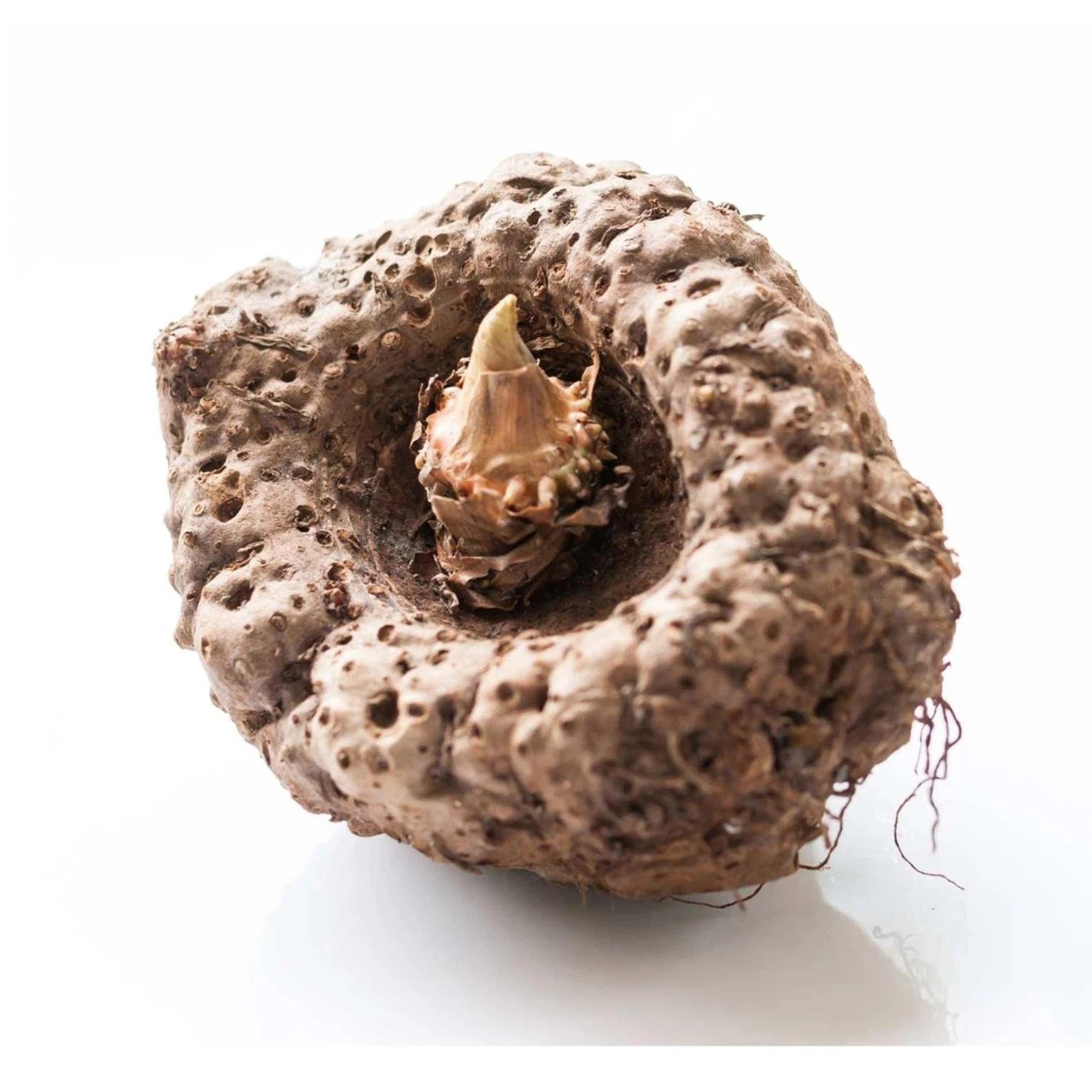 Blood Pressure Management Blood Pressure Management